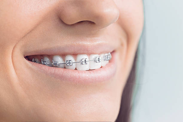 Trusted Fort Collins, CO Holistic Dental Care Services Experts